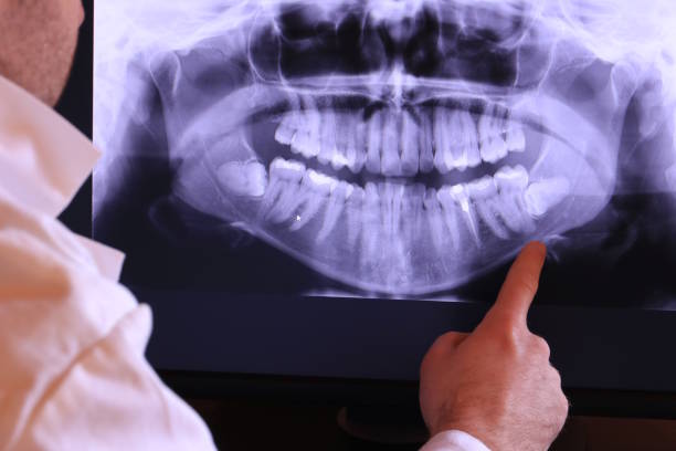 Best Emergency Treatment for Jaw Pain or Injury in Noank, CT